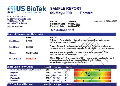 A sample of the color-coded results from a US BioTek GI Advanced Profile stool analysis report.