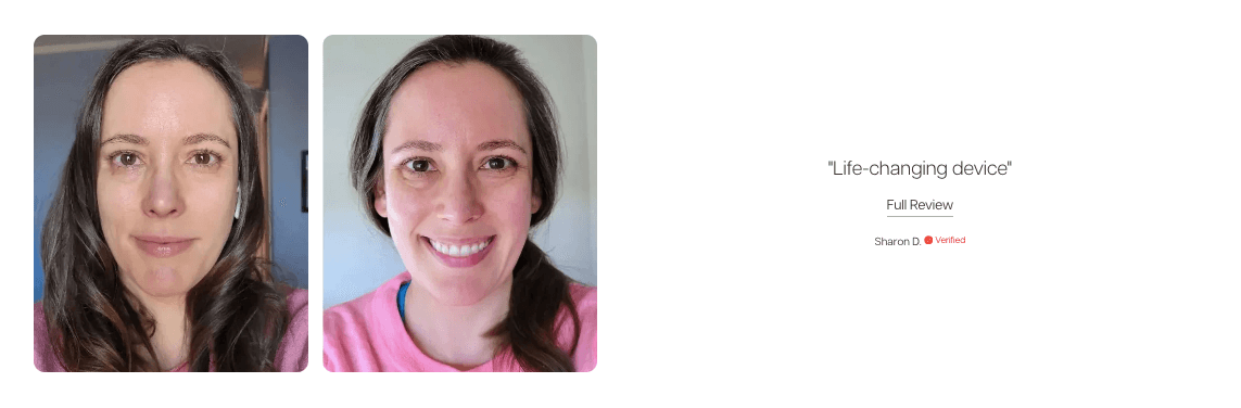 Before and after photo showing improved youthful appearance after using a Mito panel.