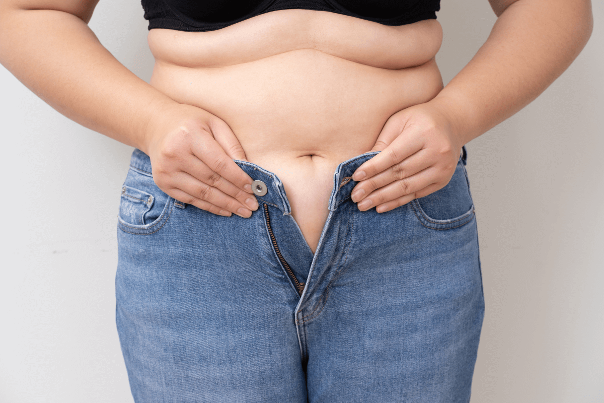 a probiotic supplement can help you have a healthy gut to lose weight